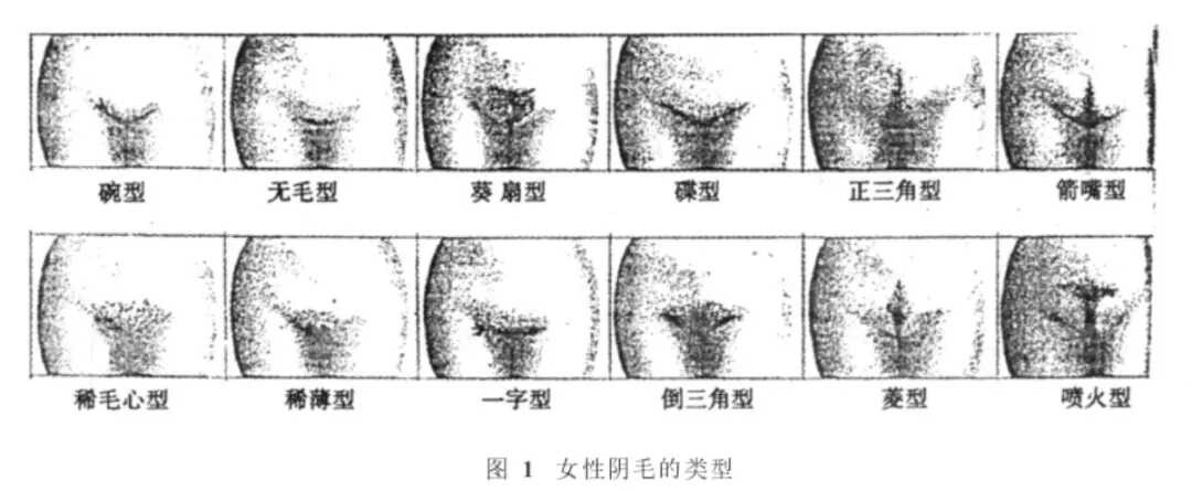 女生私处的毛毛越茂盛，性欲就越强吗？