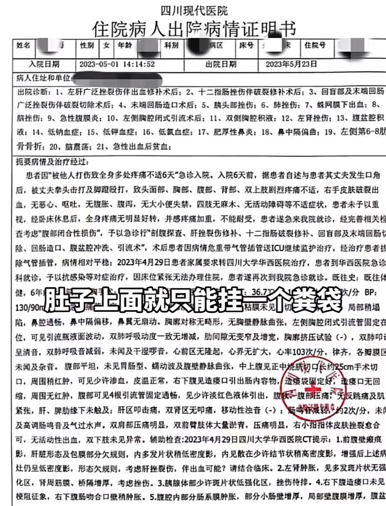 成都美女小谢被丈夫打断肠子，需长期挂粪袋[16P]