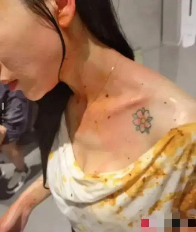 成都美女小谢被丈夫打断肠子，需长期挂粪袋[16P]