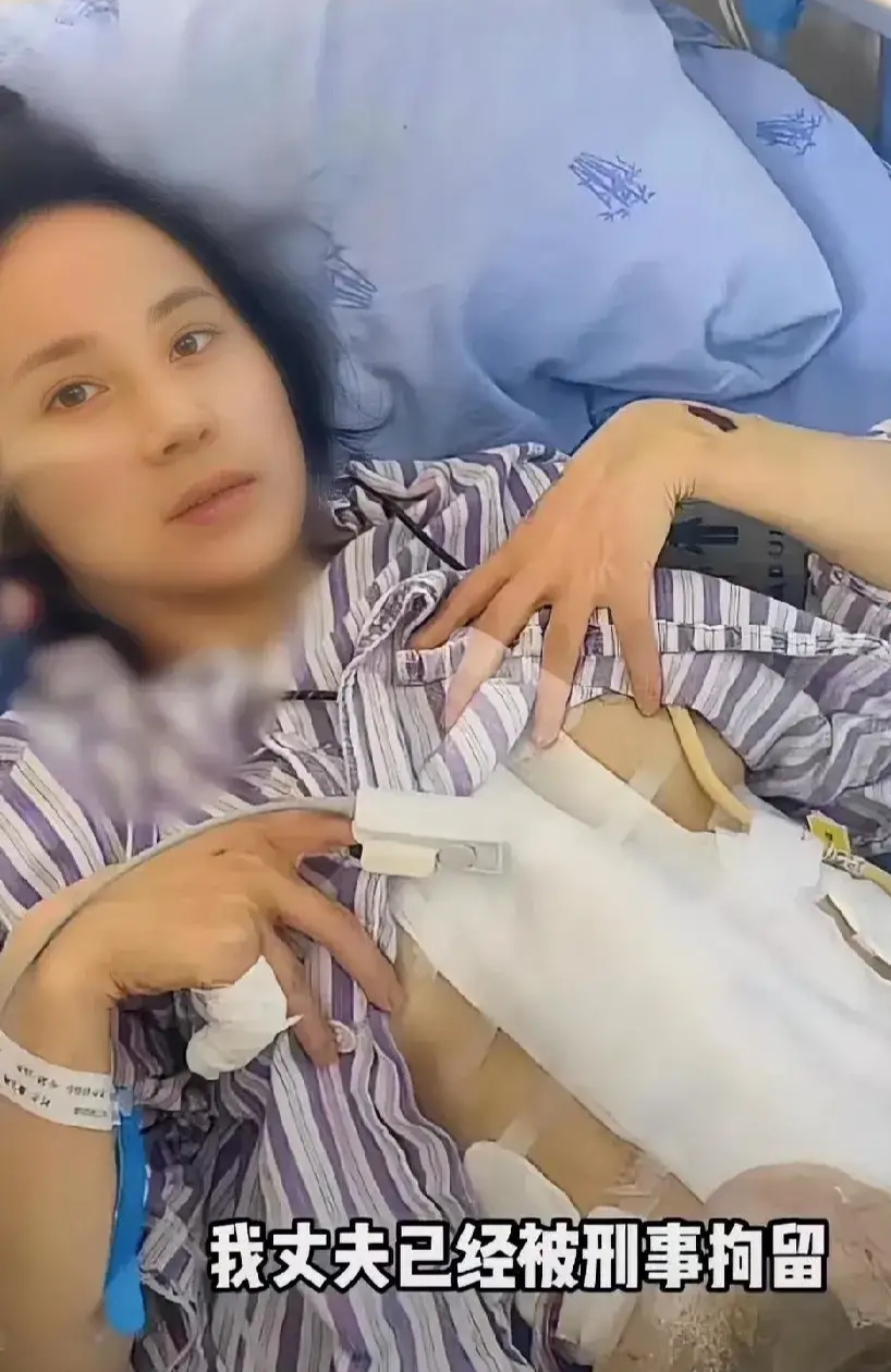 成都美女小谢被丈夫打断肠子，需长期挂粪袋[16P]