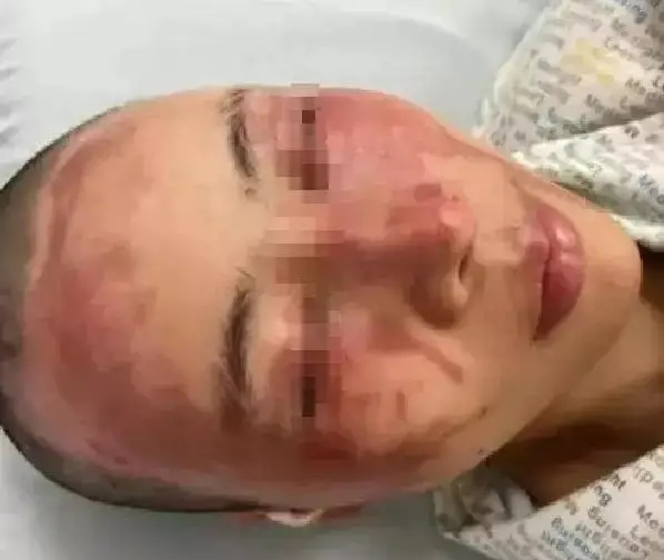 成都美女小谢被丈夫打断肠子，需长期挂粪袋[16P]