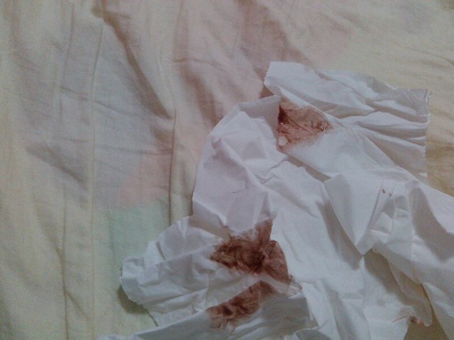 在手术台上给小护士爆了菊[25P]