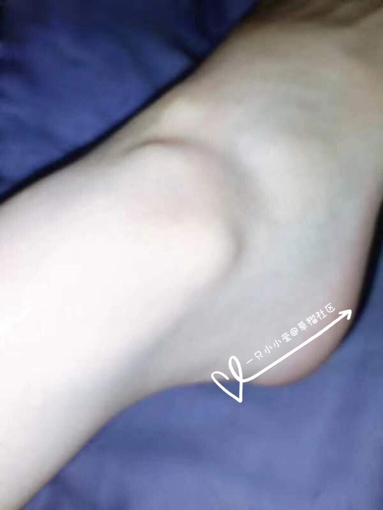 渴望被关注的小莹莹