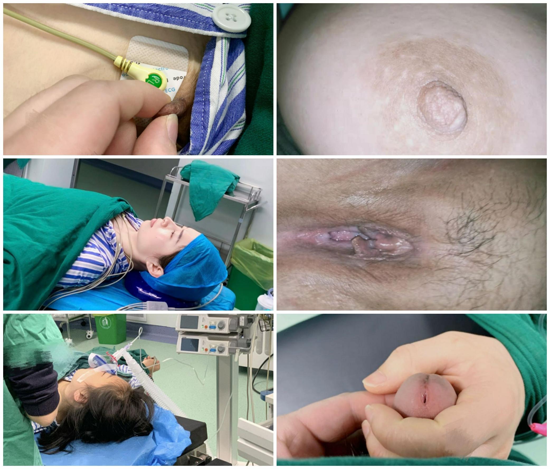 泄密流出 麻醉科色狼医生趁美女术前麻醉的时候 旁边没人偷偷猥亵偷拍病人私处