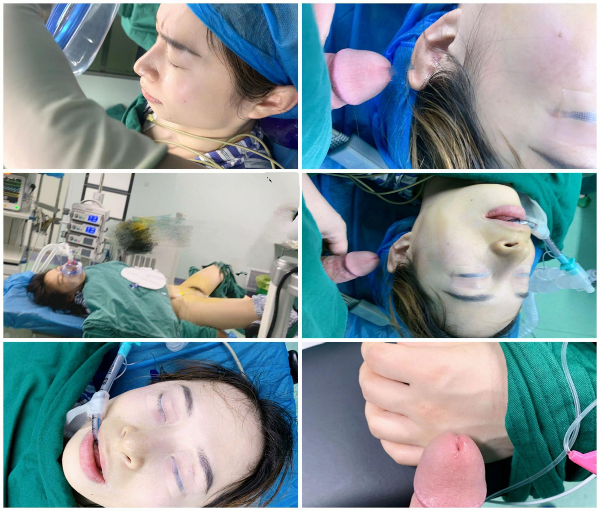 泄密流出 麻醉科色狼医生趁美女术前麻醉的时候 旁边没人偷偷猥亵偷拍病人私处