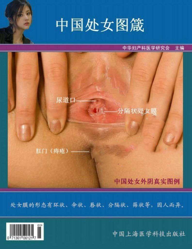 如何分辨纯天然处女和后期人工手术修复的处女膜 给狼友们科普下小知识