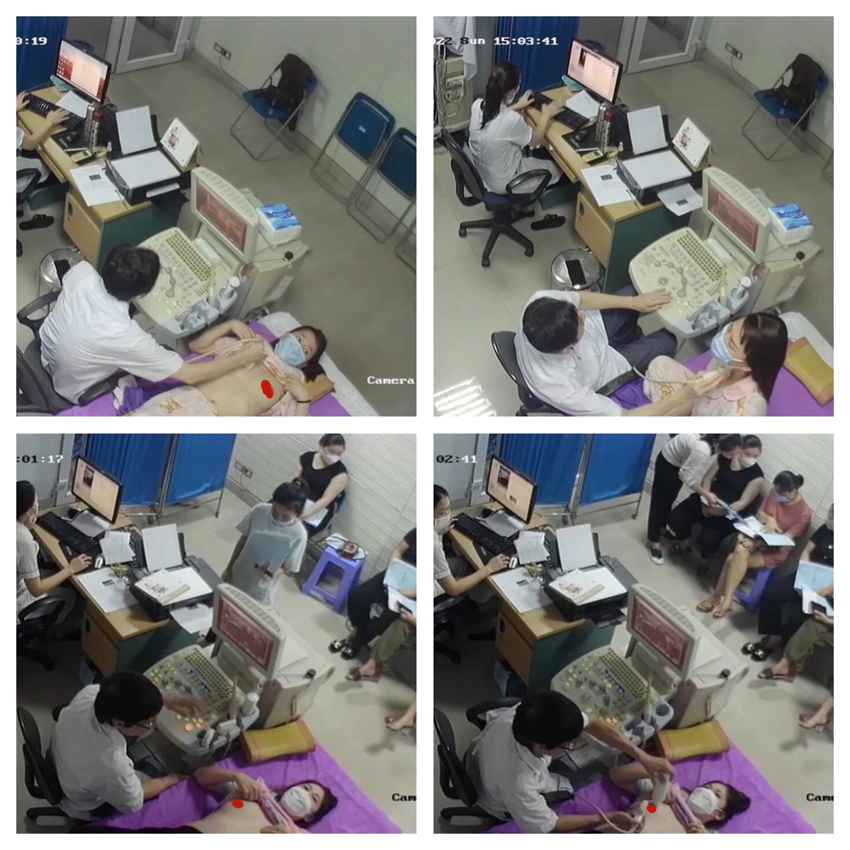 稀有黑客破解医院摄像头偷拍妇科B超阴道检查少妇 笑着进去被超长设备插入捂着逼瘸着走出来