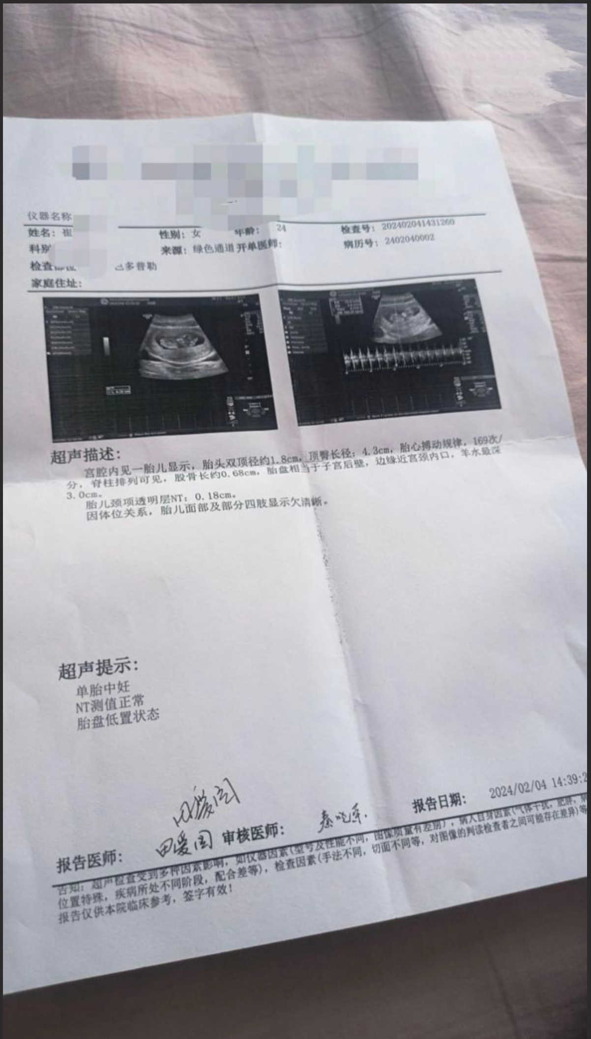 山东最美的爱妻 崔XK 被绿帽癖老公送人操 请把你们的精液都射给她