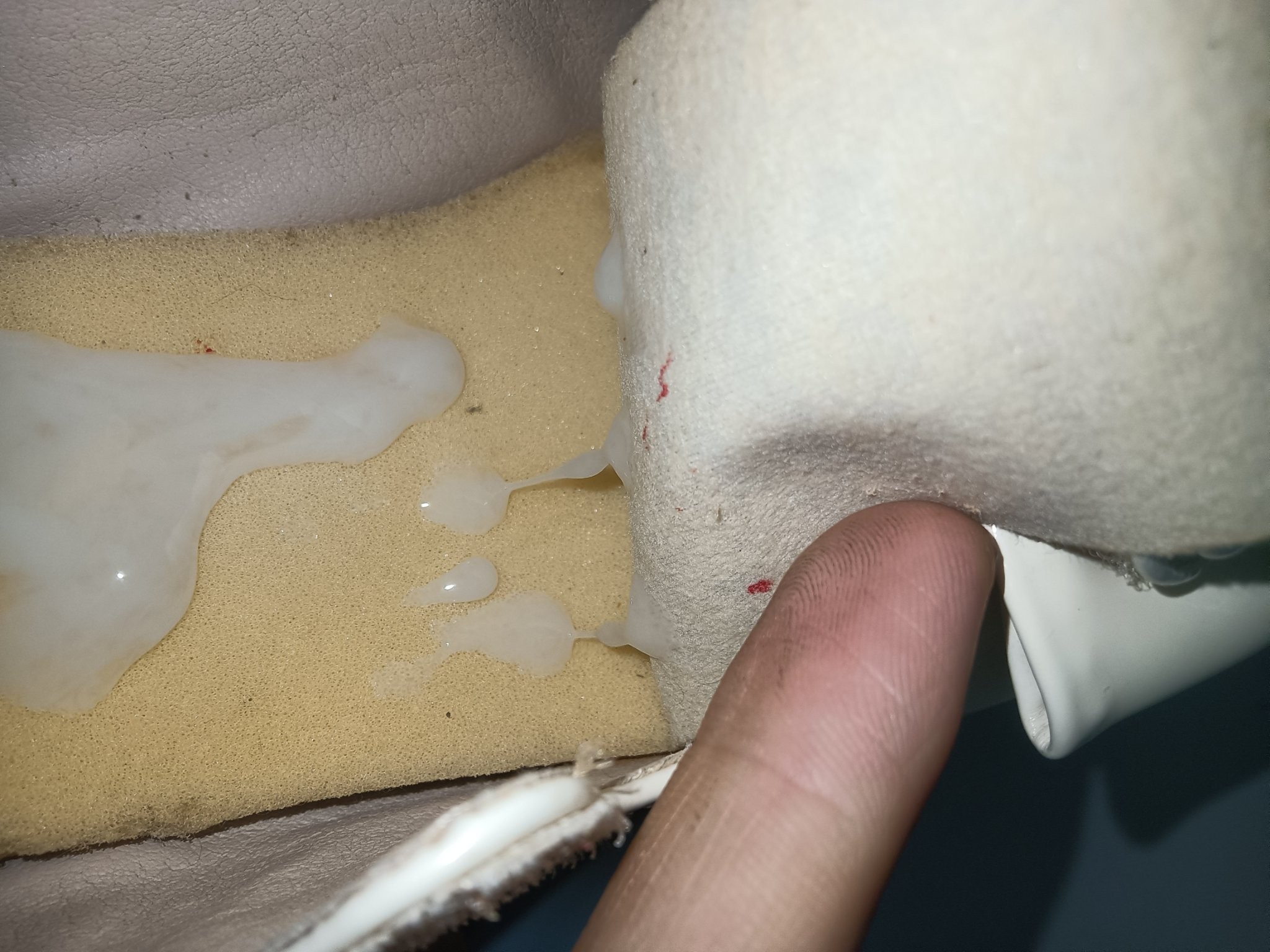 精液异常，排查13件事[10P]