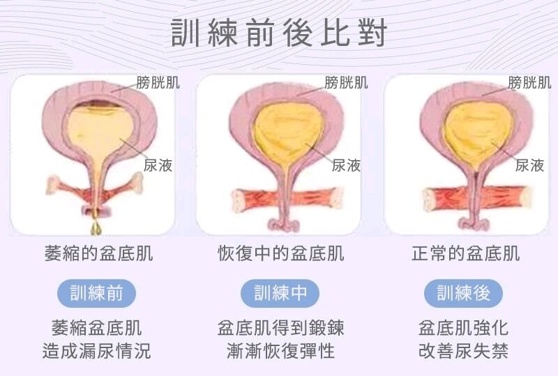 男女双修的 PC 肌训练