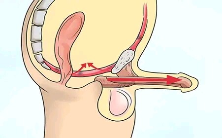 男女双修的 PC 肌训练