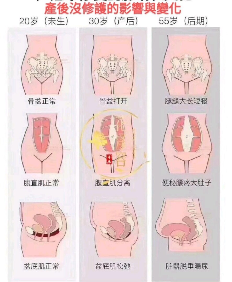 男女双修的 PC 肌训练