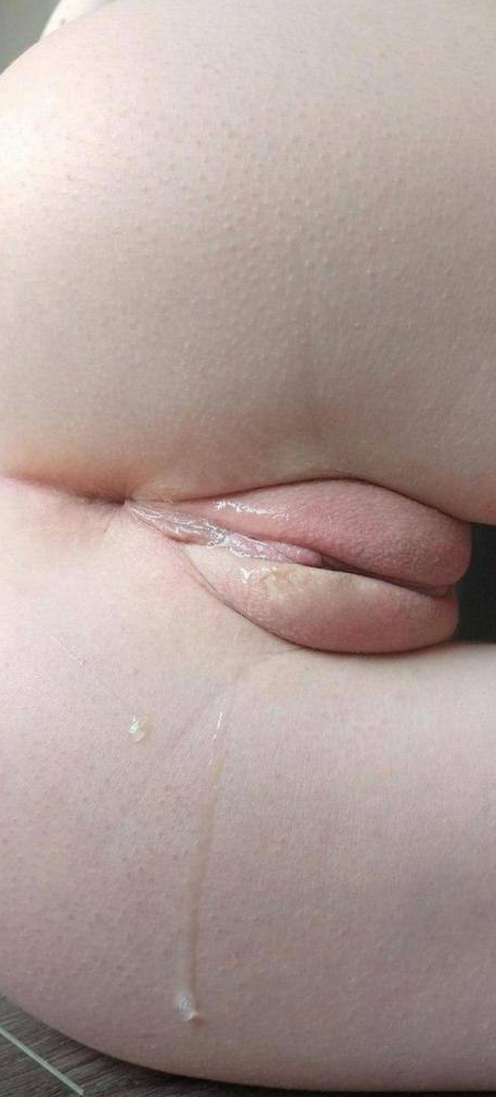 刮阴毛的优缺点以及注意事项