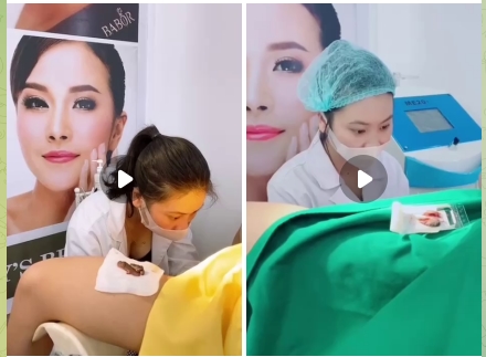 私处整容想要变粉嫩嫩 那就来做美容逼