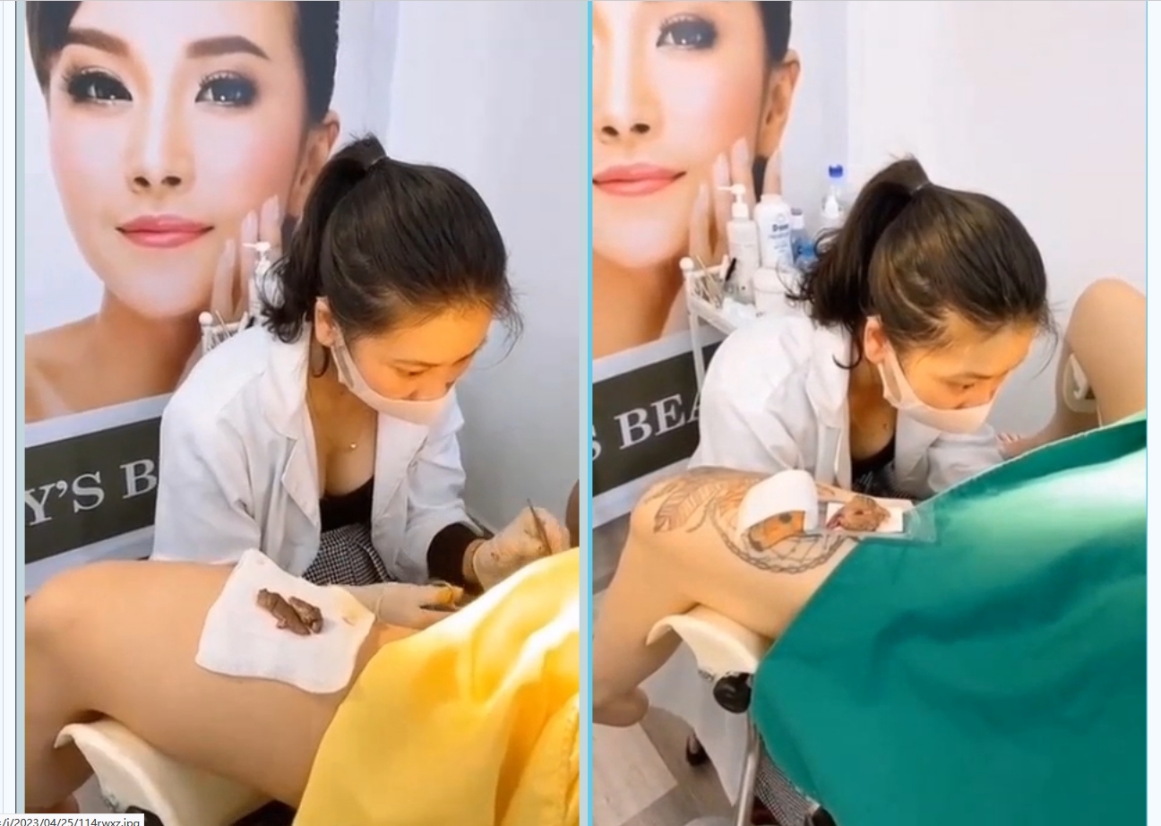 私处整容想要变粉嫩嫩 那就来做美容逼