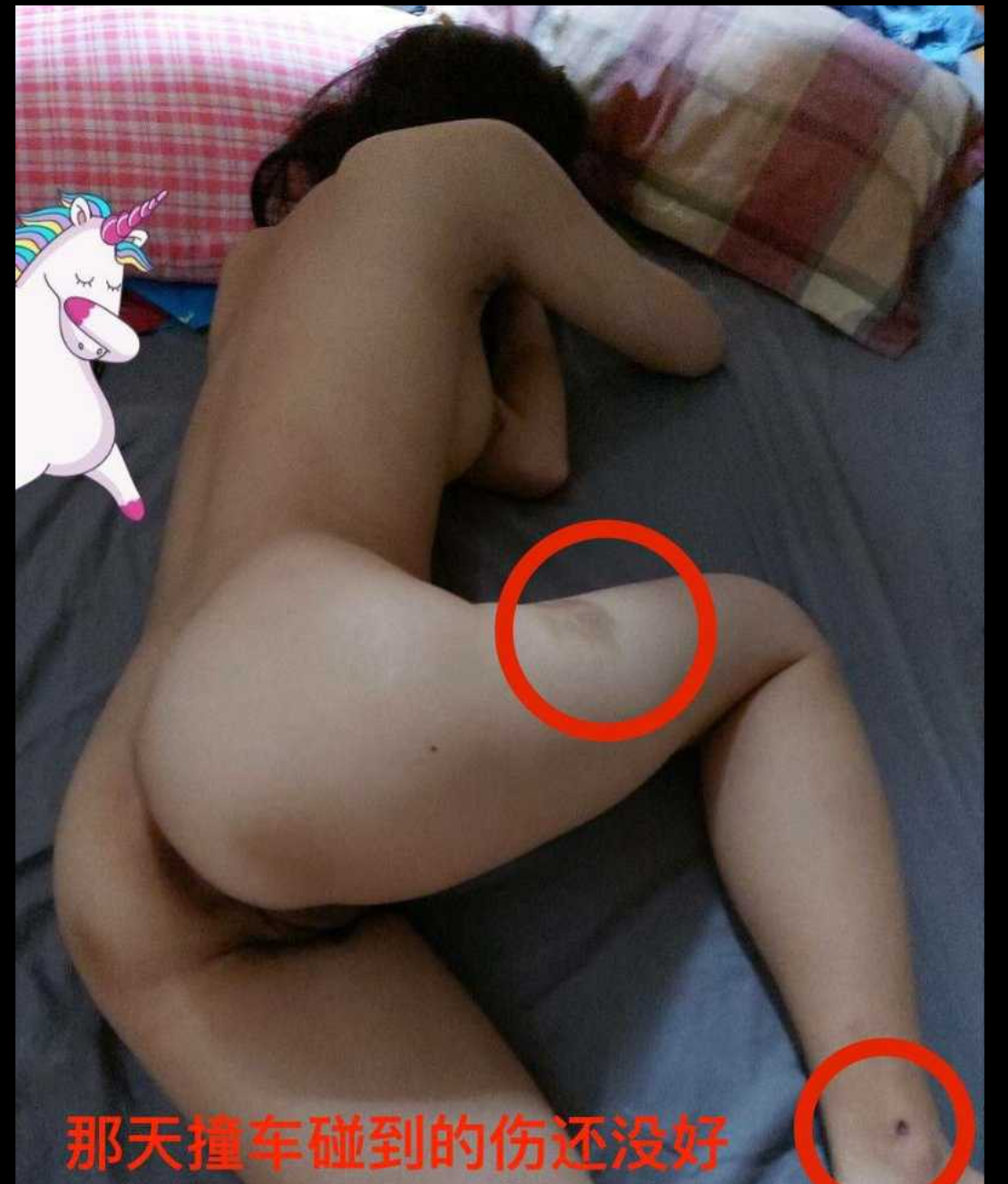 26岁姑娘被车撞后且被车主搭讪事件后续 经过车主不懈努力成功拿下 小仙女是又被撞又被操