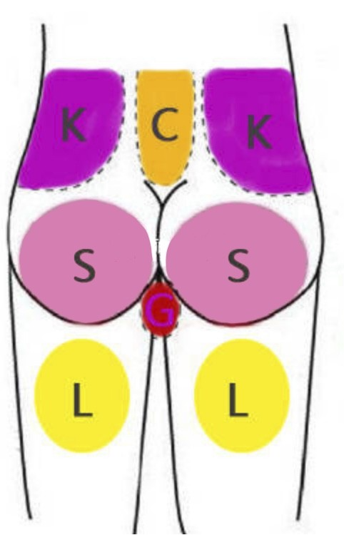 SM教程--Spank打屁股全攻略