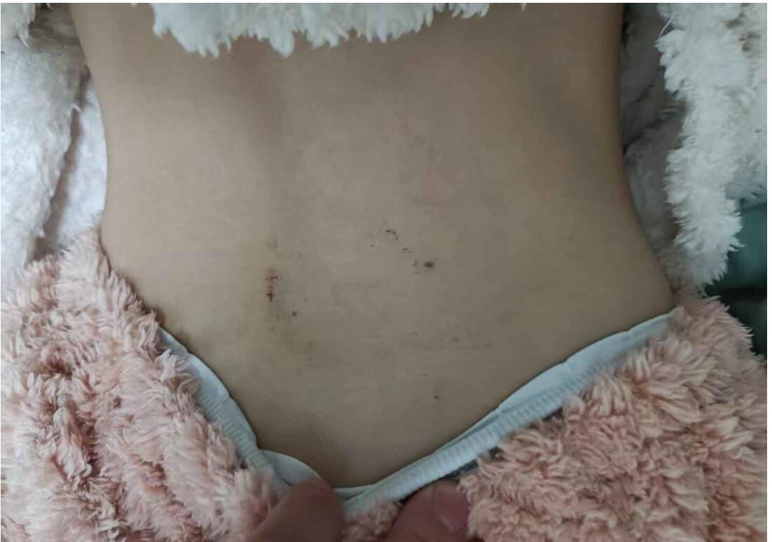 小姨子的迷你胸