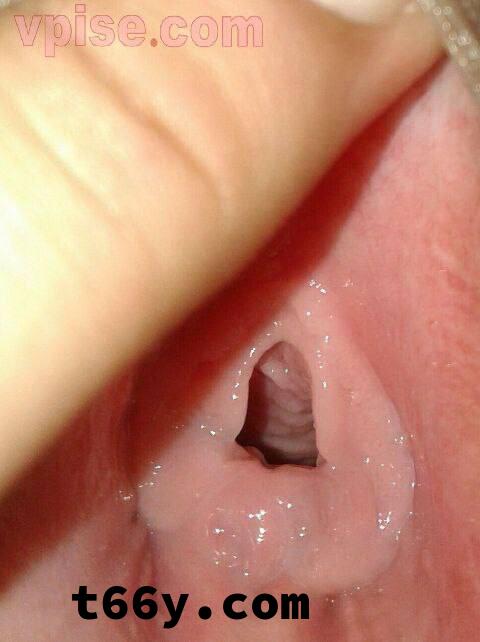 处女膜到底长什么样，看实物