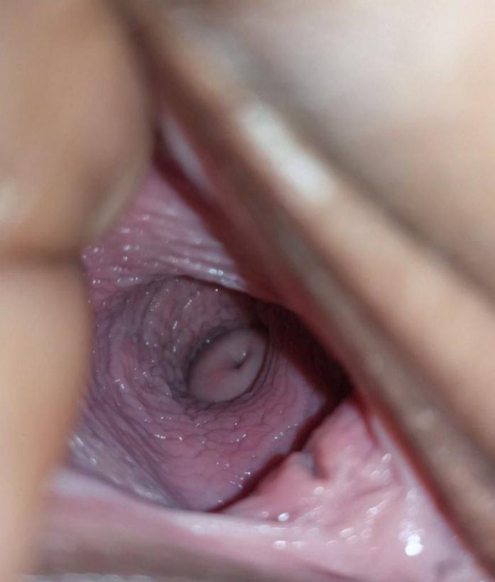 女性长期没有性生活有什么影响吗?