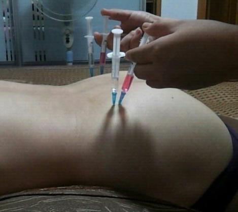 一些老图打针图片屁股好看