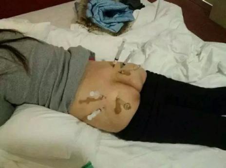 一些老图打针图片屁股好看