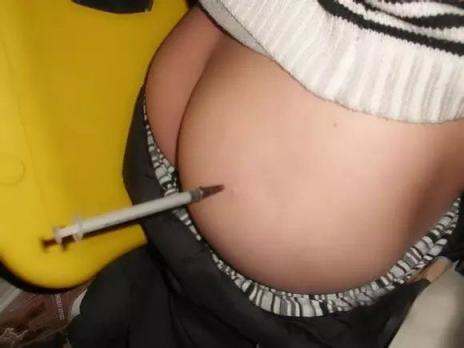 一些老图打针图片屁股好看