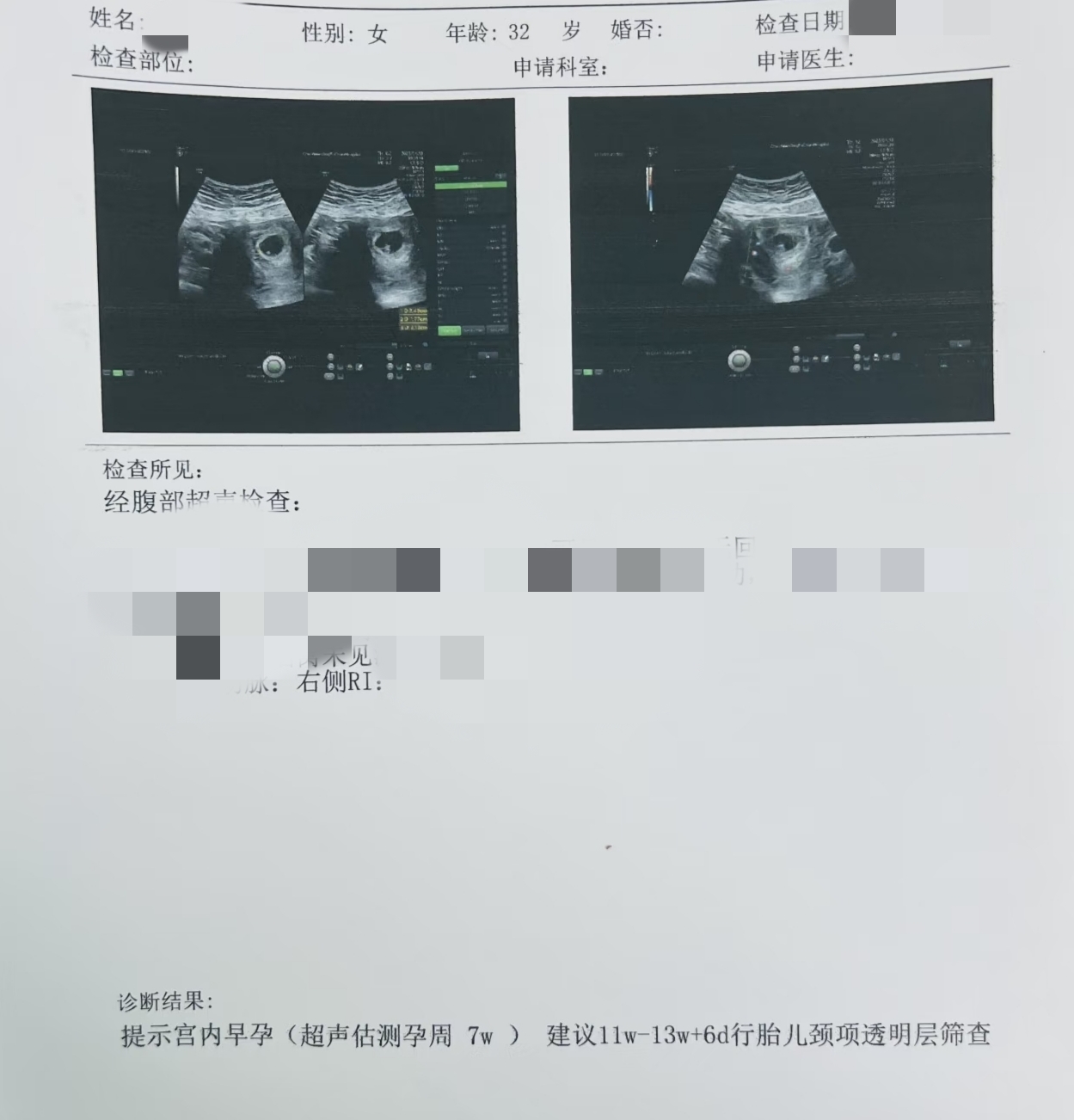 酷爱被无套的少妇玩多人，却意外有了野种